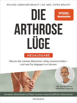 cover image of Die Arthrose-Lüge--Neuausgabe